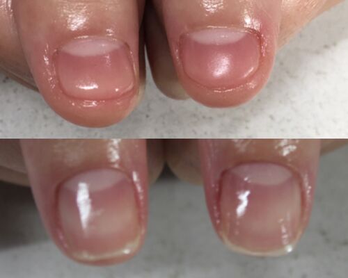 line_765786404696310