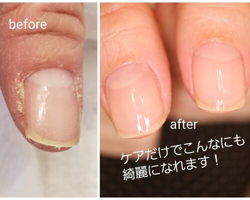 21-03-16-12-37-22-645_deco