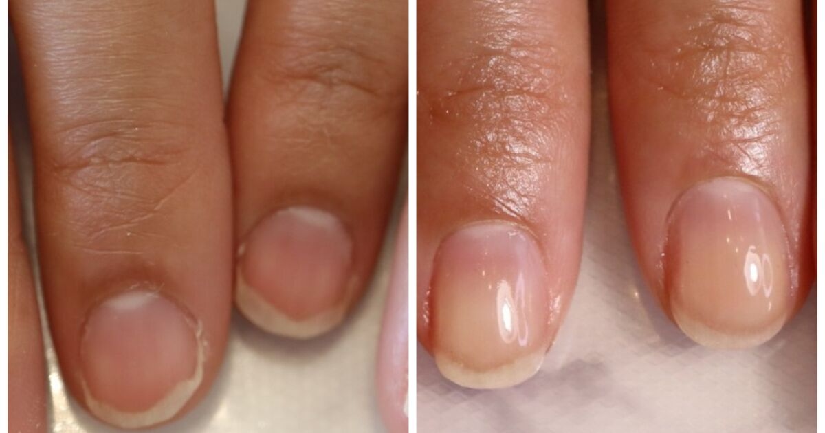 神戸の高技術ネイルサロン 自爪育成 深爪育成ネイルケアサロンは ジュネフィール神戸新長田へ 新長田で話題のネイル を施術する当店のネイリストが公式ブログを更新