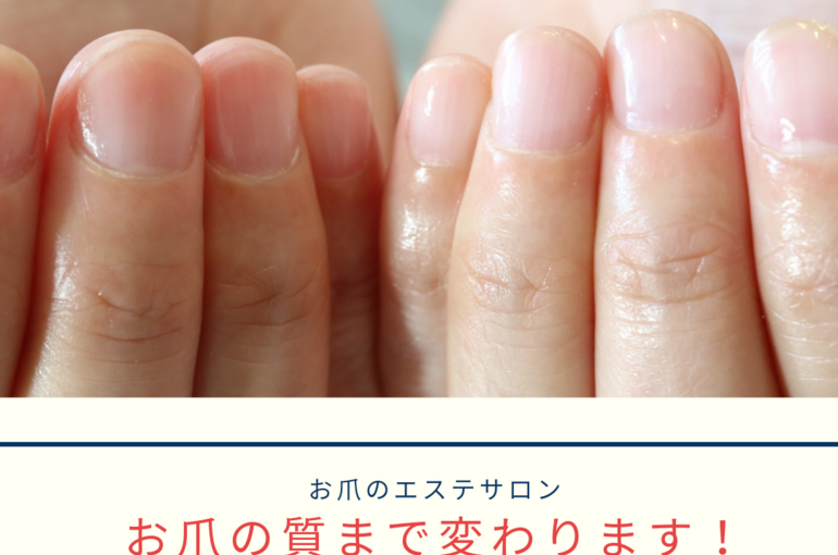 神戸ネイルサロン 深爪育成自爪育成ケアで爪質まで変わります 新長田で話題のネイルを施術する当店のネイリストが公式ブログを更新