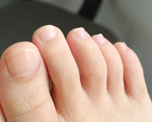 IMG-2940