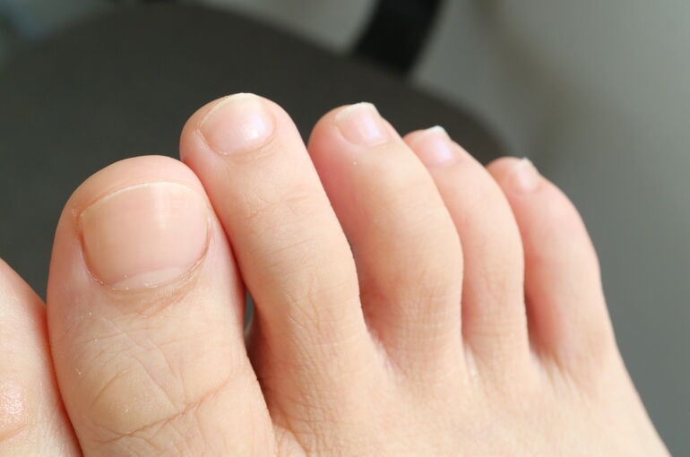 IMG-2940