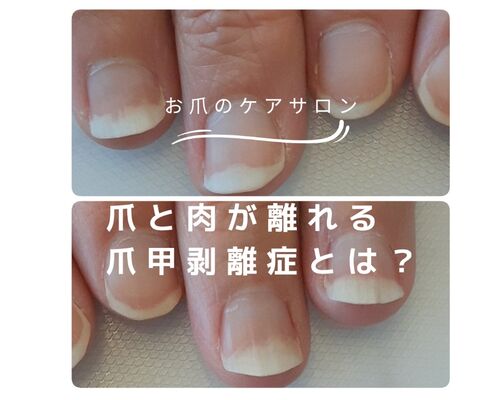 EEC00AA8-6B55-4CAE-84C4-92A02388933A