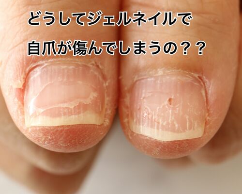 41A1EE55-D5A8-4E62-92E3-B595F501EB91