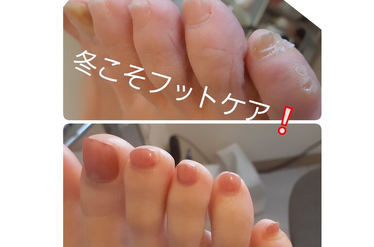 73EFF2AD-1F96-4F26-BAF2-B1CAFDCAD357
